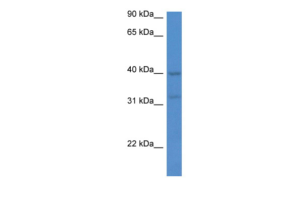 Immunoblot analysis of 6 different C-terminal Myc/DDK tagged overexpression lysates(Lane 1.CST4;2.LSM1;3.ALDOB;4.ALDH3A1;5.PLK1;6.METTL16) with TA592569 at 1:3000.