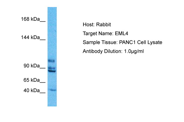 Immunoblot analysis of randomly picked 8 different lysates containing 4 different mouse IgG isotype (IgG1, IgG2a, IgG2b, IgG3) with TA592637 at 1:2000. The 8 lysates came from different sources.