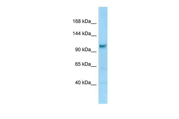 NGAL ELISA with 6C3 Capture (TA600554) and 10F11Detection ([TA700555]) Antibodies. Substrate used:  Recombinant Human NGAL (HEK293 cells  expressed protein)