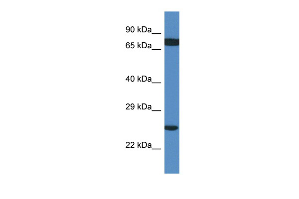 S100A8/A9  ELISA with 11C6 Capture ([TA600557]) and 5A9 Detection (TA700557) Antibodies. Substrate used: Recombinant Human S100A8/A9 ((E.coli  expressed protein)