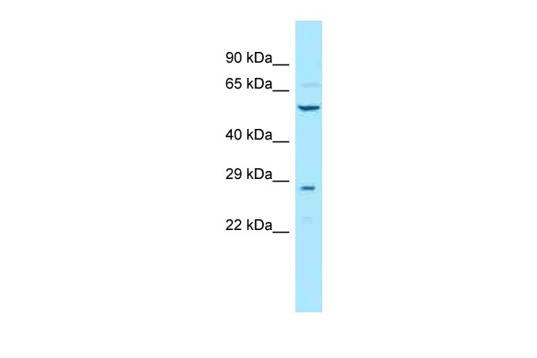 WB Suggested Anti-Tbce Antibody Titration: 1.0 ug/ml Positive Control: Mouse Liver