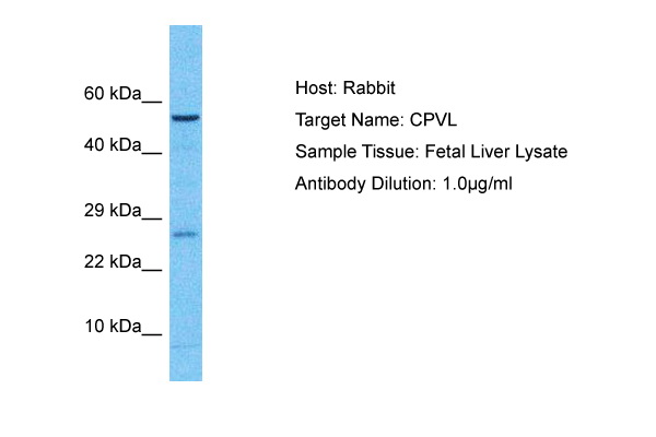 Host: Rabbit Target Name: CPVL Sample Type: Fetal Liver lysates Antibody Dilution: 1ug/ml