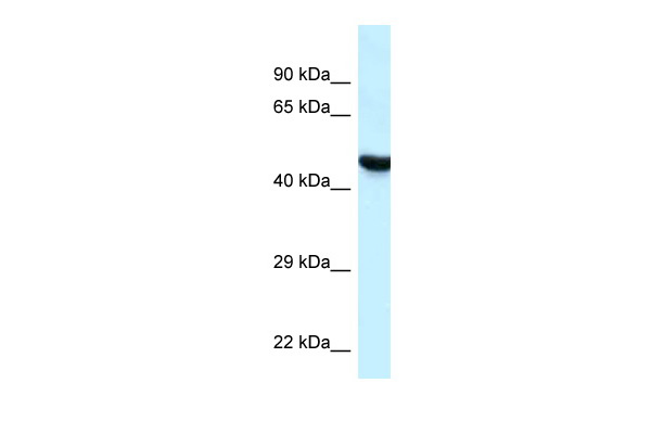 WB Suggested Anti-HYAL3 Antibody Titration: 1.0 ug/ml Positive Control: MCF7 Whole Cell