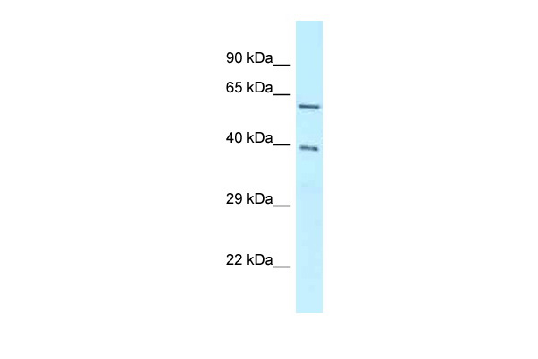 WB Suggested Anti-BAG4 Antibody Titration: 1.0 ug/ml Positive Control: RPMI-8226 Whole Cell