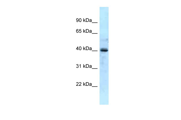 WB Suggested Anti-GALK1 Antibody Titration: 1.0 ug/ml Positive Control: Fetal Liver