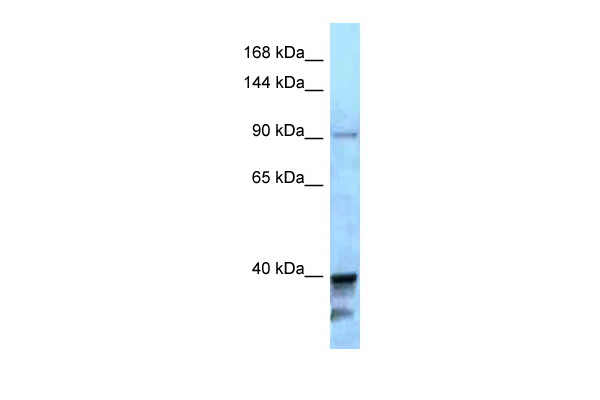 WB Suggested Anti-KIF7 Antibody Titration: 1.0 ug/ml Positive Control: A549 Whole Cell
