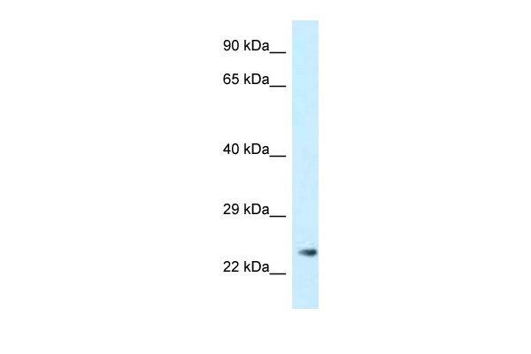WB Suggested Anti-MS4A3 Antibody Titration: 1.0 ug/ml Positive Control: 721_B Whole Cell