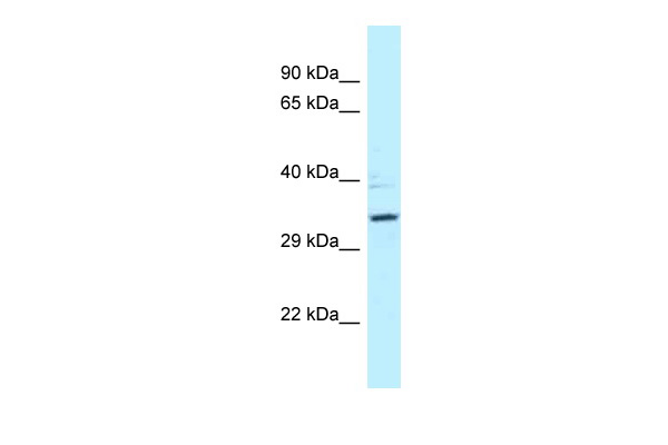 WB Suggested Anti-PPP2R4 Antibody Titration: 1.0 ug/ml Positive Control: MDA-MB-435S Whole CellPPP2R4 is strongly supported by BioGPS gene expression data to be expressed in Human MDA-MB435 cells