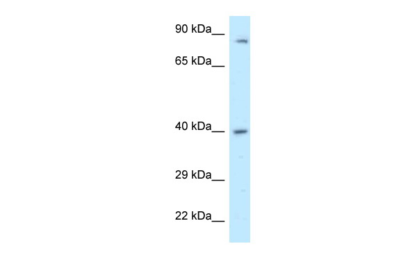 WB Suggested Anti-PPP2R4 Antibody Titration: 1.0 ug/ml Positive Control: 721_B Whole CellPPP2R4 is strongly supported by BioGPS gene expression data to be expressed in Human 721_B cells