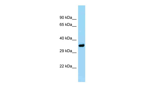 WB Suggested Anti-Pitpna Antibody Titration: 1.0 ug/ml Positive Control: Mouse Small Intestine