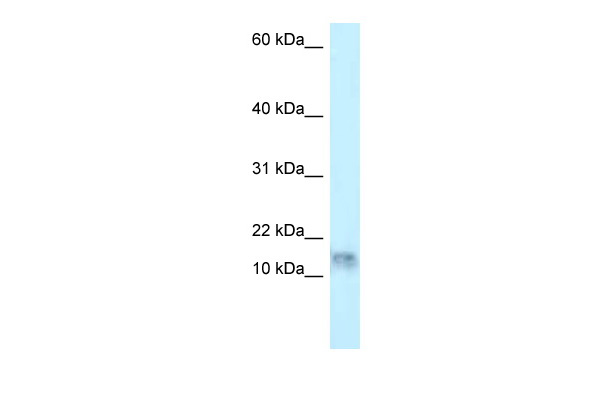 WB Suggested Anti-DNAL1 Antibody Titration: 1.0 ug/ml Positive Control: HepG2 Whole Cell