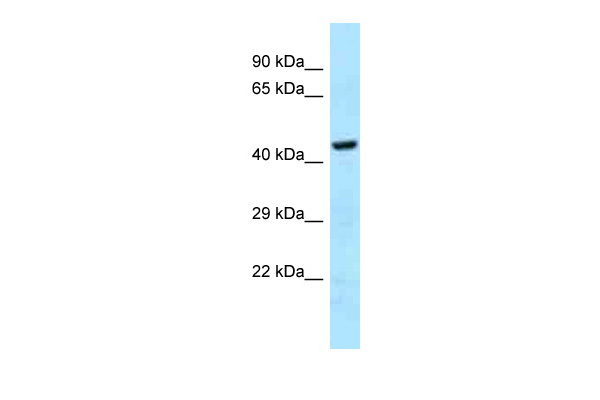 WB Suggested Anti-GHDC Antibody Titration: 1.0 ug/ml Positive Control: 721_B Whole Cell