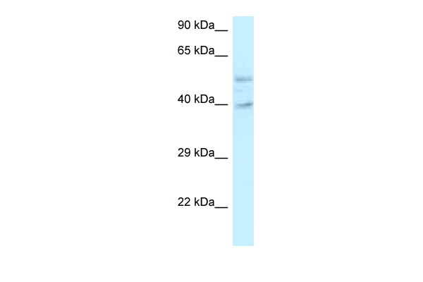WB Suggested Anti-GRINL1A Antibody Titration: 1.0 ug/ml Positive Control: Placenta