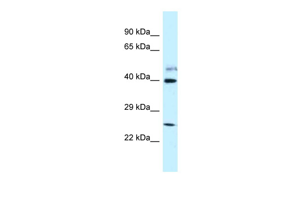 WB Suggested Anti-GRINL1A Antibody Titration: 1.0 ug/ml Positive Control: Fetal Lung