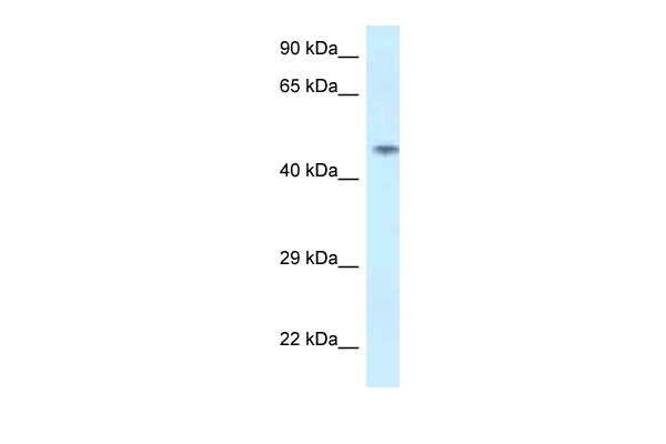 WB Suggested Anti-SPOCK2 Antibody Titration: 1.0 ug/ml Positive Control: Jurkat Whole Cell