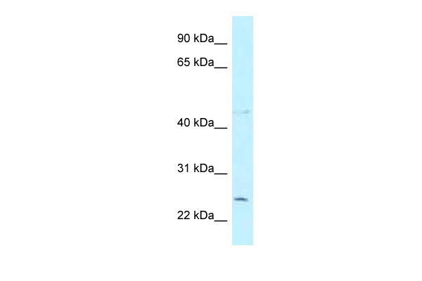 WB Suggested Anti-CCDC85B Antibody Titration: 1.0 ug/ml Positive Control: COLO205 Whole Cell