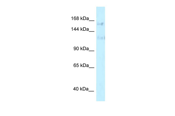 WB Suggested Anti-PRPF40A Antibody Titration: 1.0 ug/ml Positive Control: HepG2 Whole CellPRPF40A is strongly supported by BioGPS gene expression data to be expressed in Human HepG2 cells