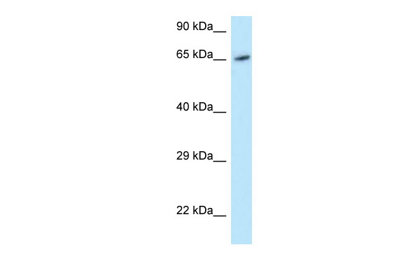 WB Suggested Anti-MOXD1 Antibody Titration: 1.0 ug/ml Positive Control: Hela Whole Cell