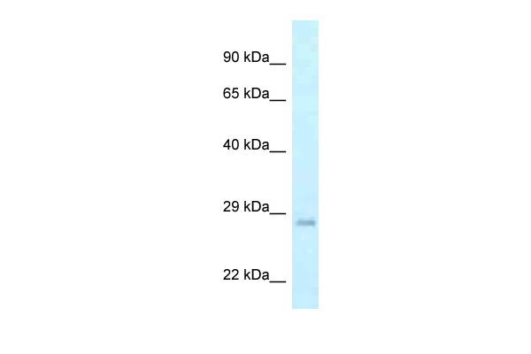WB Suggested Anti-GADD45GIP1 Antibody Titration: 1.0 ug/ml Positive Control: Hela Whole CellGADD45GIP1 is supported by BioGPS gene expression data to be expressed in HeLa