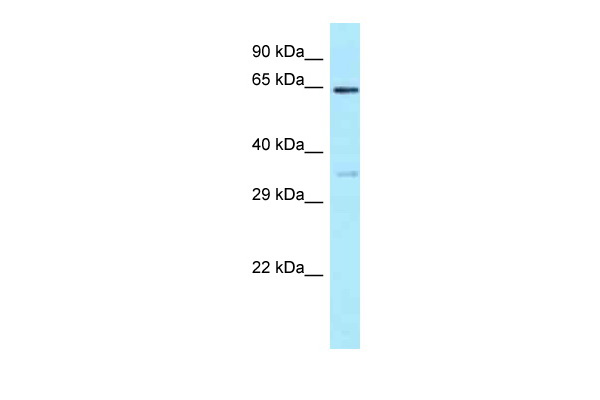 WB Suggested Anti-EIF3D Antibody Titration: 1.0 ug/ml Positive Control: HT1080 Whole CellEIF3D is supported by BioGPS gene expression data to be expressed in HT1080