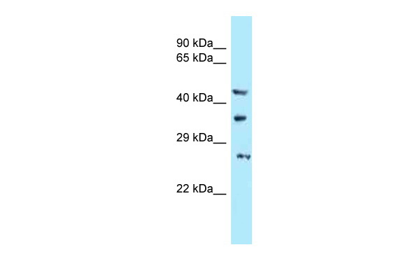 WB Suggested Anti-C16orf57 Antibody Titration: 1.0 ug/ml Positive Control: PANC1 Whole Cell