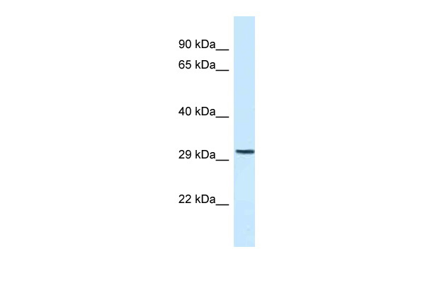 WB Suggested Anti-C18orf1 Antibody Titration: 1.0 ug/ml Positive Control: Fetal Heart