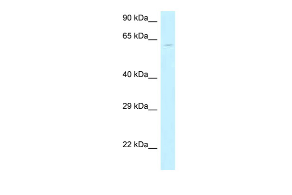 WB Suggested Anti-MON1B Antibody Titration: 1.0 ug/ml Positive Control: Hela Whole CellMON1B is supported by BioGPS gene expression data to be expressed in HeLa