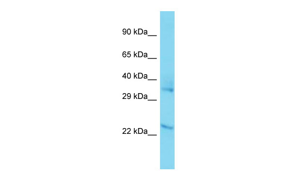 Western blot analysis of  recombinant   SARS-CoV-2 Spike-RBD protein (Cat#TP750182, 0.02ug) by using anti-SARS-CoV-2 spike protein antibody (TA890231). (1：5000)