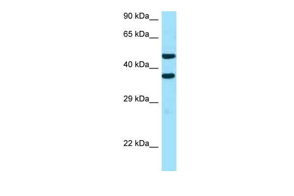 WB Suggested Anti-SFXN2 Antibody Titration: 1.0 ug/ml Positive Control: NCI-H226 Whole Cell
