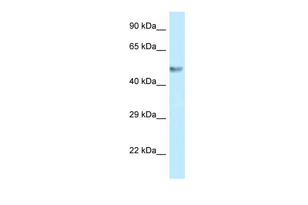 WB Suggested Anti-BZW1 Antibody Titration: 1.0 ug/ml Positive Control: 293T Whole Cell