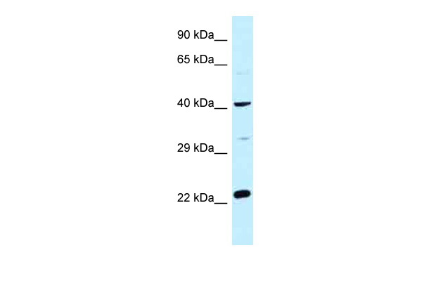 WB Suggested Anti-CCDC68 Antibody Titration: 1.0 ug/ml Positive Control: Fetal Heart