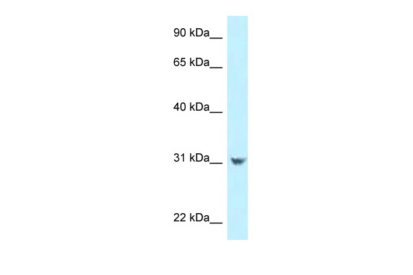 WB Suggested Anti-CCDC102B Antibody Titration: 1.0 ug/ml Positive Control: HepG2 Whole Cell