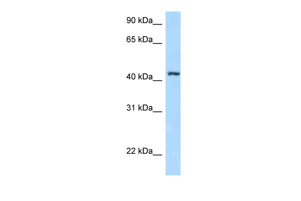 WB Suggested Anti-FBXL8 Antibody Titration: 1.0 ug/ml Positive Control: Jurkat Whole Cell