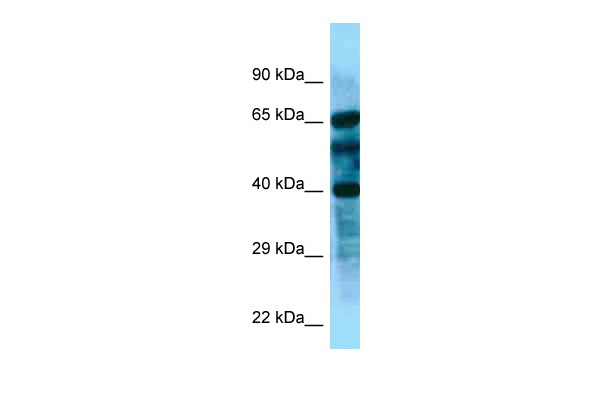WB Suggested Anti-FBXL8 Antibody Titration: 1.0 ug/ml Positive Control: Fetal kidney