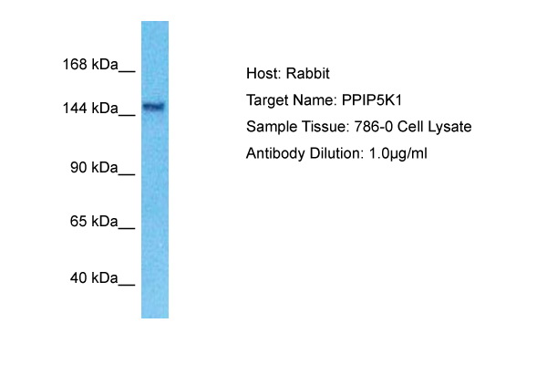 Host: Rabbit Target Name: PPIP5K1 Sample Type: 786-0 Whole Cell lysates Antibody Dilution: 1.0ug/ml