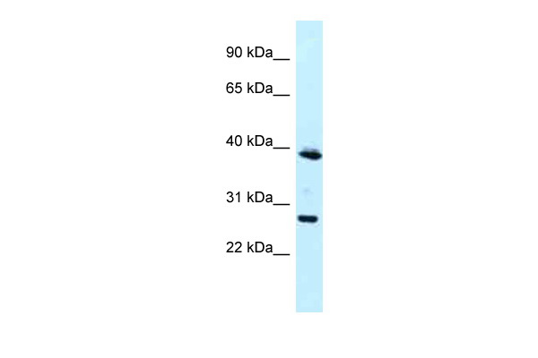 WB Suggested Anti-MAGEF1 Antibody Titration: 1.0 ug/ml Positive Control: Jurkat Whole Cell