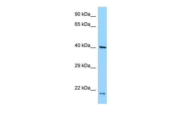 WB Suggested Anti-PRPF18 Antibody Titration: 1.0 ug/ml Positive Control: NCI-H226 Whole CellPRPF18 is strongly supported by BioGPS gene expression data to be expressed in NCI-H226
