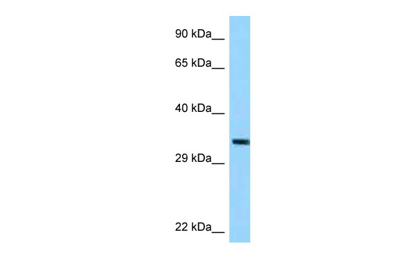 WB Suggested Anti-TRUB1 Antibody Titration: 1.0 ug/ml Positive Control: ACHN Whole Cell