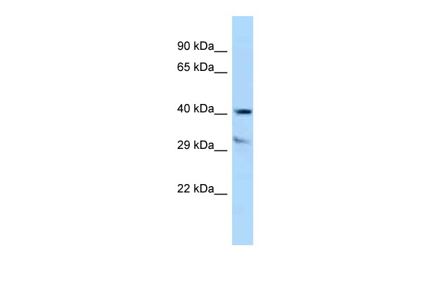 WB Suggested Anti-TTPA Antibody Titration: 1.0 ug/ml Positive Control: Jurkat Whole Cell
