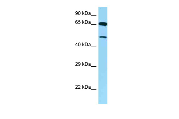 WB Suggested Anti-AVPR1B Antibody Titration: 1.0 ug/ml Positive Control: RPMI-8226 Whole Cell