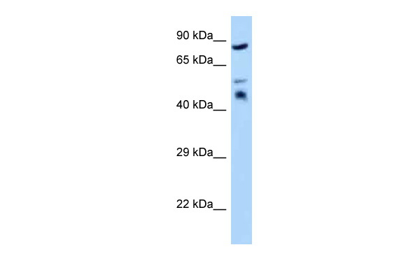 WB Suggested Anti-TES Antibody Titration: 1.0 ug/ml Positive Control: Hela Whole CellTES is strongly supported by BioGPS gene expression data to be expressed in Human HeLa cells