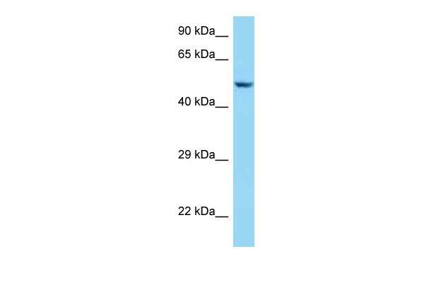 WB Suggested Anti-SRL Antibody Titration: 1.0 ug/ml Positive Control: MDA-MB-435S Whole Cell