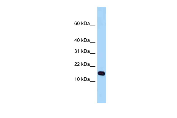 WB Suggested Anti-STH Antibody Titration: 1.0 ug/ml Positive Control: Fetal Heart