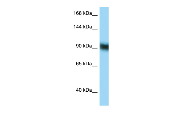 WB Suggested Anti-ZFP62 Antibody Titration: 1.0 ug/ml Positive Control: RPMI-8226 Whole Cell