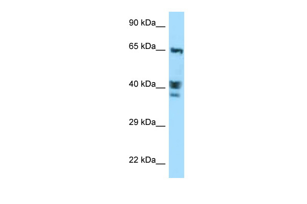 WB Suggested Anti-ACTL8 Antibody Titration: 1.0 ug/ml Positive Control: MCF7 Whole Cell