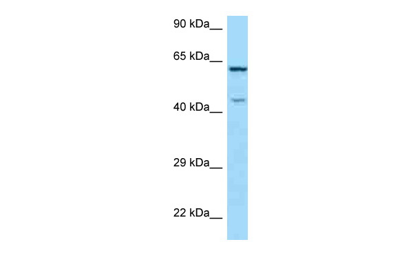 WB Suggested Anti-ARMCX5 Antibody Titration: 1.0 ug/ml Positive Control: Hela Whole CellARMCX5 is supported by BioGPS gene expression data to be expressed in HeLa