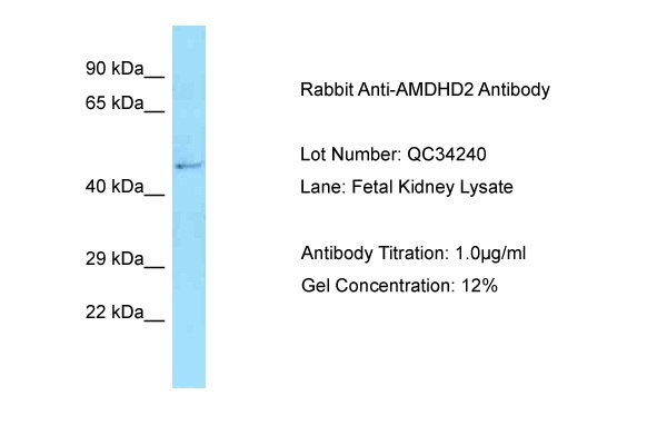 Host: Rabbit Target Name: AMDHD2 Sample Type: Fetal Kidney Antibody Dilution: 1.0ug/ml