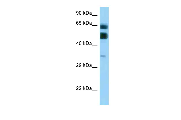 WB Suggested Anti-C16orf70 Antibody Titration: 1.0 ug/ml Positive Control: Placenta