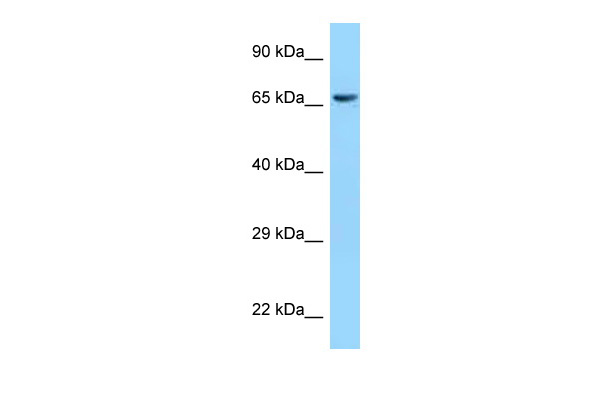 WB Suggested Anti-CLPX Antibody Titration: 1.0 ug/ml Positive Control: 293T Whole CellCLPX is supported by BioGPS gene expression data to be expressed in HEK293T