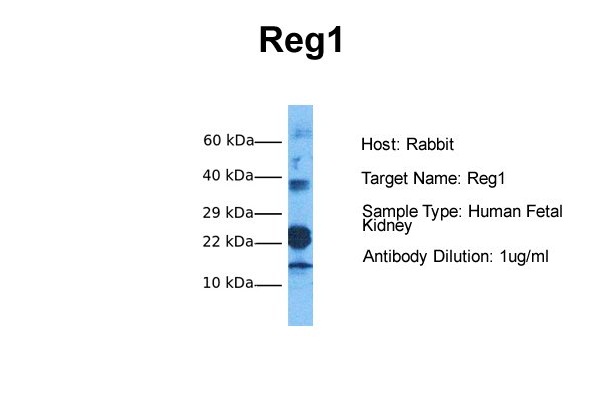 Host: Rabbit Target Name: Reg1 Sample Tissue: Human Fetal Kidney Antibody Dilution: 1.0ug/ml